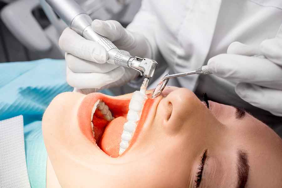 The Importance of Professional Dental Cleanings in Alachua, FL