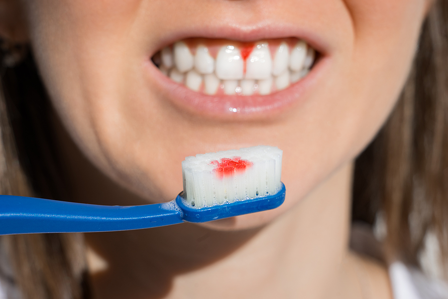 Protect Your Smile: Essential Tips for Prevention & Gum Care in Alachua, FL